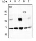 Anti-HMB45 Antibody