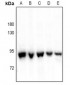 Anti-P5CS Antibody