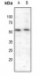 Anti-MEF2A (pS408) Antibody