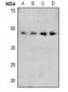 Anti-CRK (pY221) Antibody
