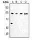Anti-Glucocorticoid Receptor (pS226) Antibody