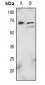 Anti-AKT (pT72) Antibody