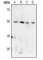 Anti-MK2 (pT222) Antibody