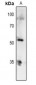 Anti-p53 (pT81) Antibody