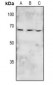 Anti-BRK (pY447) Antibody