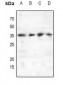 Anti-C/EBP epsilon (pT74) Antibody
