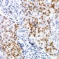 Anti-CDK7 (pT170) Antibody