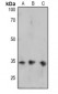 Anti-FOSB (pS27) Antibody