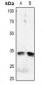 Anti-IGFBP3 (pS183) Antibody