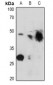Anti-Kir6.2 (pT224) Antibody