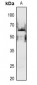 Anti-PAK1 (pS199) Antibody
