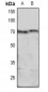 Anti-MARCKS (pS158) Antibody