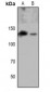 Anti-EPHA8 (pY615) Antibody