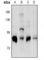 Anti-PKC delta (pS664) Antibody