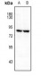 Anti-FRS2 (pY196) Antibody