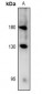 Anti-RET (pY981) Antibody