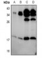 Anti-BIK (pS35) Antibody