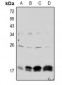 Anti-Claudin 4 (pY208) Antibody