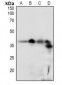 Anti-DSCR1 (pS108) Antibody