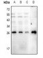 Anti-RGS19 (pS151) Antibody