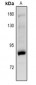Anti-PKC gamma (pT514) Antibody