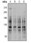 Anti-E Cadherin (pS844) Antibody