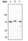 Anti-BTK Antibody