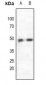 Anti-CCR5 Antibody
