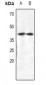 Anti-CRKL Antibody