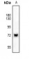 Anti-SYK Antibody