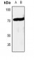 Anti-c-RAF Antibody