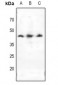 Anti-Doublecortin Antibody