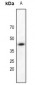 Anti-DAP Kinase 2 Antibody