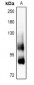 Anti-CD91 Antibody