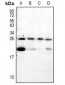 Anti-Pleiotrophin Antibody