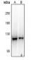 Anti-EPHB3 Antibody