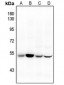 Anti-CD47 Antibody