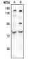Anti-BMAL1 (AcK538) Antibody