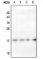 Anti-Histone H2A (AcK95) Antibody