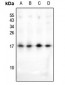 Anti-HMGN2 (AcK31) Antibody