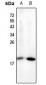 Anti-NF-E4 (AcK43) Antibody
