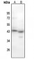 Anti-MYOD1 (pS200) Antibody