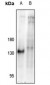 Anti-NFAT1 (pS326) Antibody