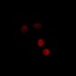 Anti-Progesterone Receptor (pS400) Antibody