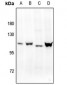 Anti-Progesterone Receptor (pS400) Antibody