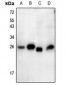 Anti-Thymidine Kinase 1 (pS13) Antibody