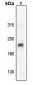 Anti-VEGFR2 (pY1059) Antibody