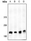 Anti-53BP1 (pS6) Antibody
