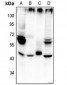 Anti-Beta-2 Adrenergic Receptor (pS355/S356) Antibody