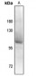 Anti-Androgen Receptor (pS94) Antibody